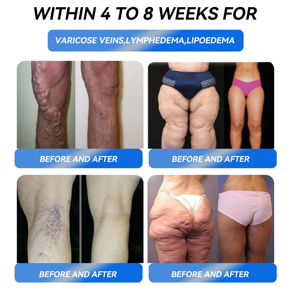𝐈𝐅𝐌𝐀𝐆𝐈𝐂® 𝐆𝐋𝐏-𝟏 𝐏𝐫𝐨 𝐖𝐞𝐢𝐠𝐡𝐭 𝐋𝐨𝐬𝐬 𝐎𝐫𝐚𝐥 𝐒𝐨𝐥𝐮𝐭𝐢𝐨𝐧 Visible results in 7 days, no side effects, suitable for all age groups 🌹🌹