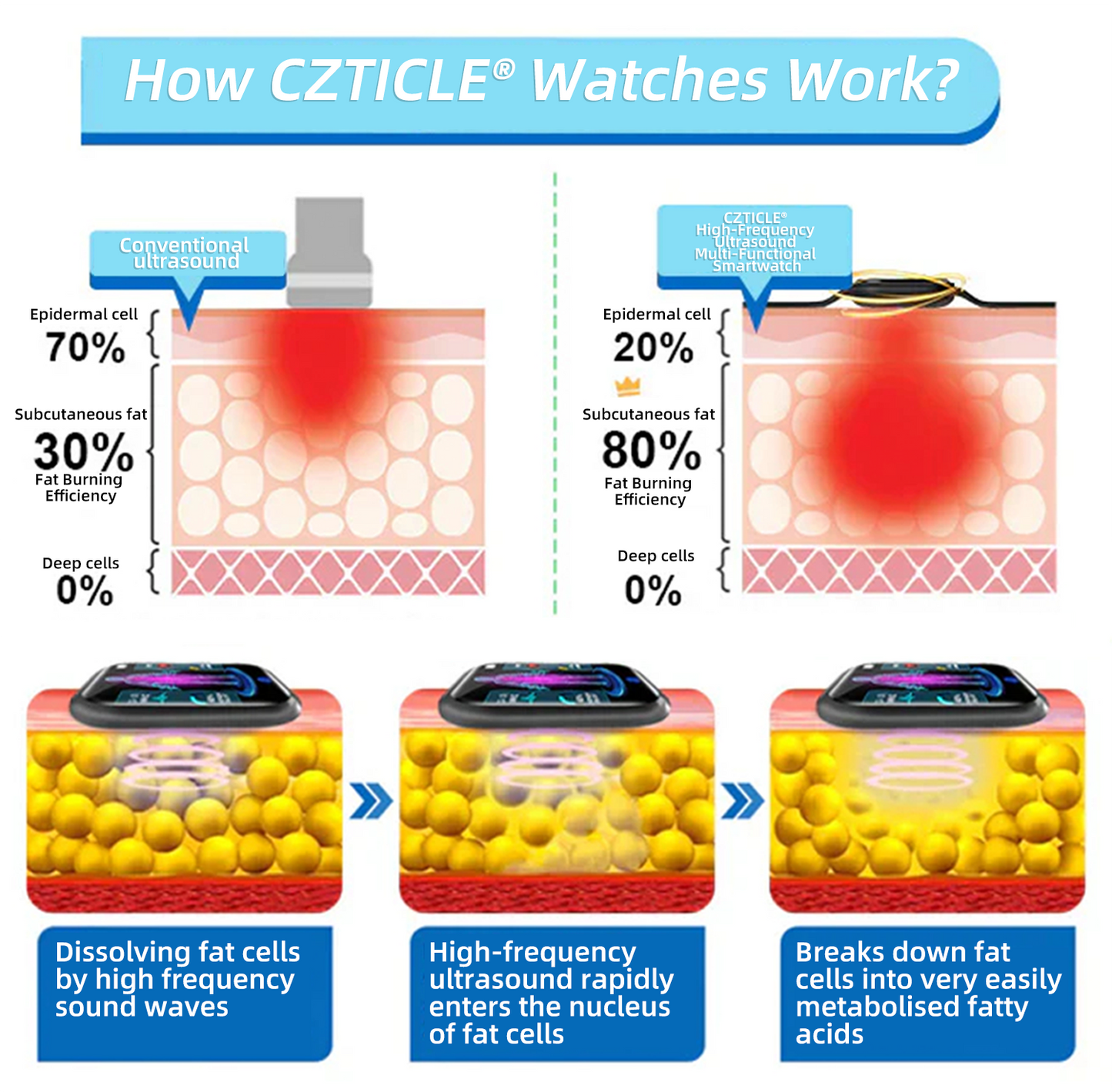 CZTICLE® High-Frequency Ultrasound Multi-Functional Smartwatch(Specifically Designed for Fat Burning, Blood Sugar Balance, Lymphatic Detox, Edema Reduction, and Nerve Relaxation) 💃💃