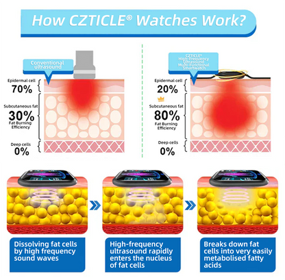 CZTICLE® High-Frequency Ultrasound Multi-Functional Smartwatch(Specifically Designed for Fat Burning, Blood Sugar Balance, Lymphatic Detox, Edema Reduction, and Nerve Relaxation) 💃💃