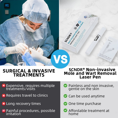 SCNDR® Non-Invasive Mole and Wart Removal Laser Pen🥝