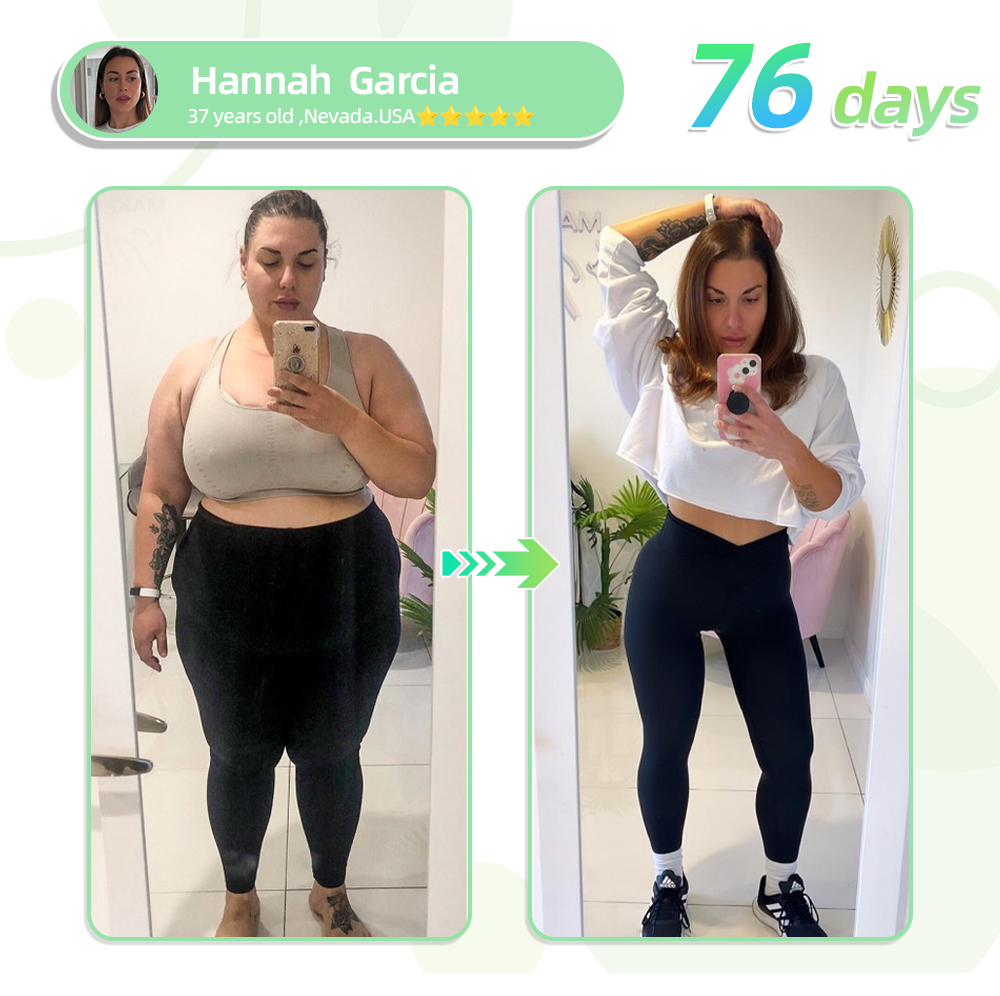 [Regain your figure in 7 days] 👩‍⚕️0yikey™ SMGT-GLP-1 Nano Microneedle Patch（Painless, long-lasting, addressing diabetes, obesity, and cardiovascular diseases）🔥🔥🔥