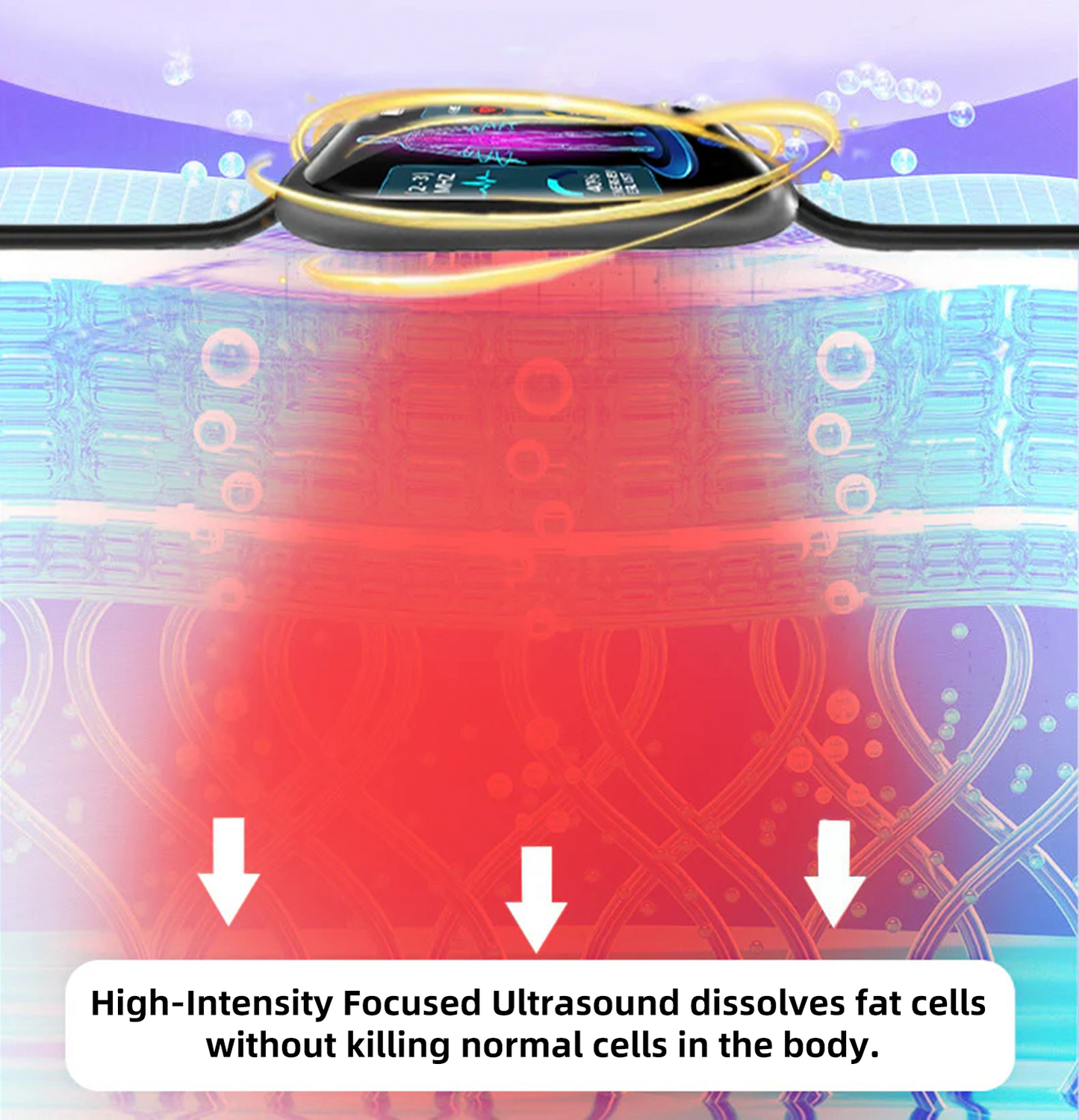CZTICLE® High-Frequency Ultrasound Multi-Functional Smartwatch(Specifically Designed for Fat Burning, Blood Sugar Balance, Lymphatic Detox, Edema Reduction, and Nerve Relaxation) 💃💃